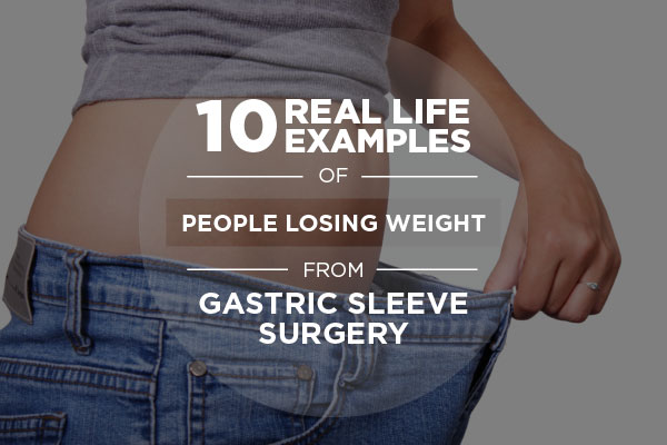 10 Real Life Examples of People Losing Weight from Gastric Sleeve Surgery